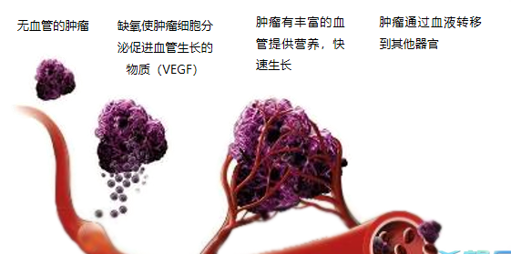 晚期腫瘤為什么會復發(fā)轉(zhuǎn)移？